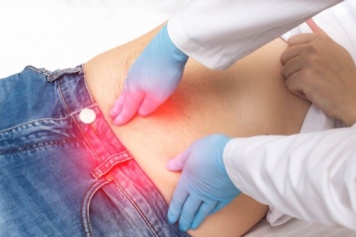 Cirugía de hernia de pared abdominal