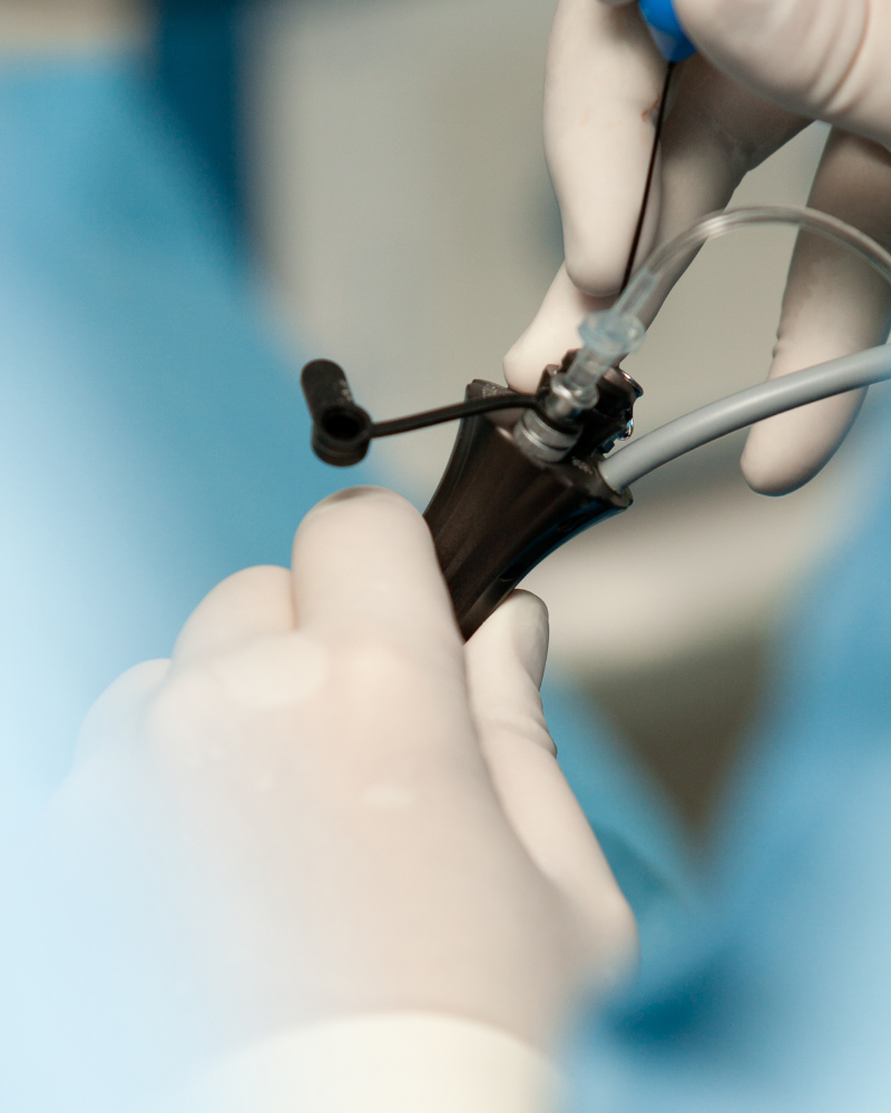 operacion-de-vesicula-por-laparoscopia-precio